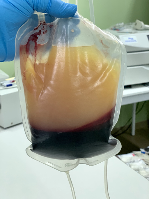 Plasma is the yellow component of blood. It is used for YPE.